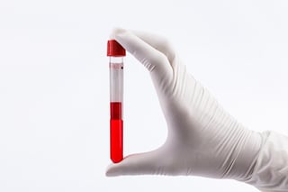 A white gloved hand holding a vial of red liquid supposed to symbolize blood