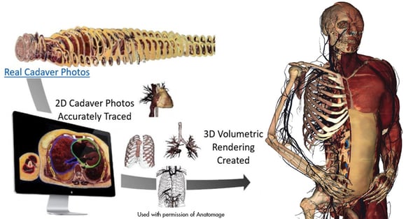 Diagram of the image generation process that transforms real cadaver photos into 3D volumetric renderings, used with permission of Anatomage